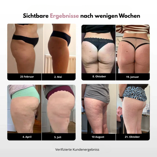 Anti-Cellulite Leggings – Lymphdrainage | Blau